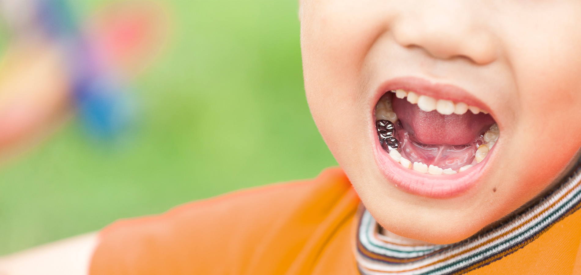 Zahnersatz bei Kinder in der Praxis für Kinder- und Jugendzahnheilkunde in Bülach